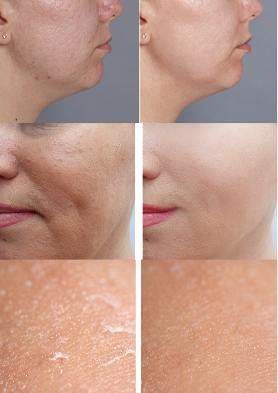 SPF 50 Pigmentation Correcting Day Cream